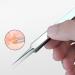 Stainless Steel Pointed Tweezers - Ingrown Hair, Blackhead & Splinter Remover - Buy Online on GoSupps.com