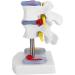 Anatomical Lumbar Intervertebral Disc Model - Spine Demonstration for Training & Education | International Shipping Available - Buy Online on GoSupps.com