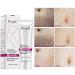 Mango Stretch Marks & Scar Removal Cream - Pregnancy & Obesity Relief (40g - Buy Online on GoSupps.com