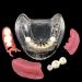 Dental Restoration Model with 3 Implants | Overdenture Teaching Study Teeth Replica - International Shipping Available - Buy Online on GoSupps.com