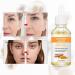 Turmeric face seruem Dark Spot Remover Essence Turmeric Serums for face Brightens Skin Tone Moisturizes Hydrates Lightens Age-Spots Acne Reduce Fine Lines Facial Care Anti-Aging Serum - Buy Online on GoSupps.com