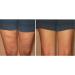 Skinnies Instant Lifts - 5 Pair Thigh Lifts | Patented USA-Made Adhesive Strips for Instantly Smoothing Cellulite | Original Shark Tank Product - Buy Online on GoSupps.com