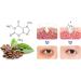 2023 New Openeyes Awaken Peptide Lifting Eye Gel for Women Peptide Gel Openeyes Lifting Eye Gel for Women Lifts Firming Anti-wrinkle Eye Tightener Dark Circles Reducing Eye Cream (3sets) - Buy Online on GoSupps.com