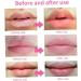 Face Masks Gel Lip Pad Hot Cold Compress Gel Pack Reusable Leakage Proof Swelling Wounds Patches - Buy Online on GoSupps.com