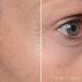 MD Complete Total Eye Treatment - Anti-Aging Hydrating Skin Renewal with Peptides, Vitamins C & E, and Hyaluronic Acid - 0.5 fl oz - Buy Online on GoSupps.com