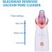 Electric Blackhead Remover Vacuum - USB Rechargeable Pore Cleaner Kit with 5 Suction Heads | Blackhead Vacuum Extractor for Acne, Comedones, and Whiteheads - Buy Online on GoSupps.com