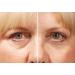 Rox Flawless Eyes by RX | Premium Eye Care for Radiant Skin | Shop Internationally Now - Buy Online on GoSupps.com