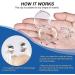 S-tash Stop Snoring - Anti Snoring Nose Strips (4 Pcs) | Snore Stopper & Solution | Comfortable Nasal Strips for Effective Results - Buy Online on GoSupps.com