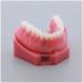 Fhuili teeth model for education-repair implant teeth model-doctor-patient-communication red dentition model simulation oral dental tooth demonstration model a