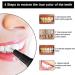 Professional Tooth Whitening Pen & Gel - Naturally Lighten Teeth Remove Stains & Achieve a Whiter Smile - Buy Online on GoSupps.com
