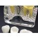 4x Enlarged Teeth Model for Dental Education | Implant & Crown Simulation | Ideal for Teaching & Demonstration - Buy Online on GoSupps.com