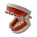 Dental Orthodontic Model with Metal Brackets and Arch Wire - Standard Teeth Model with Braces for Demonstration - Buy Online on GoSupps.com