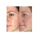 Caudalie Vinopure Anti Acne Natural Salicylic Super Serum 30ml Mixed Skin - Buy Online on GoSupps.com
