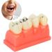 Ververt Touch Tooth Model - 180mm Dental Caries Demonstration Model for Schools & Dentists | Learning Aid for Dental Lessons - Buy Online on GoSupps.com