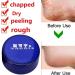 Hand Foot Crack Cream Anti Dry Chapped Cream Dry Skin Heel Chapped Peeling Ointment Hydrating Foot Cream Moisturizes for Healthy Feet Softens Conditions Dry Cracked Feet (33g) - Buy Online on GoSupps.com