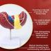 Teaching Model Human Liver Educational Model with Base and Clear Texture and Pathological Features Liver Cirrhosis Model for Medical School Study and Research - Buy Online on GoSupps.com