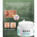 KnjoFly Japanese Melasma Cream Dr Hancy - Herbal Whitening and Dark Spot Remover for All Skin Types - Buy Online on GoSupps.com