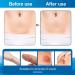 Scar Away Silicone Scar Sheets - 1.6 x 60 Roll - Surgical, C-Section, Keloid, Tummy Tuck, Burn, Stretch Marks - Reusable Scar Removal Strips - Buy Online on GoSupps.com