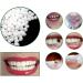 Tooth Repair Kit - Instant Temporary Teeth Replacement for Damaged & Missing Teeth | Best Dental Fix Solution - Buy Online on GoSupps.com