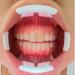 Wudaizhi Mouth Opener - 2pcs 3D Teeth Whitening Accessory | Reusable Cheek Opener for Optimal Oral Care - Buy Online on GoSupps.com