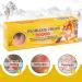 Worglo Ultimate Psoriasis Relief Cream - Soothes Irritated Itching, Controls Reoccurrences, and Comforts Scaling Skin - Buy Online on GoSupps.com