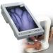 HNCXHX VEIN LOCATOR VENER Finder Finder rechargeable transilluminator Intelligent imaging you will find Venenfinder Locator Detector clear graphics for adults/children