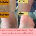 Lintat Hand & Foot Crack Cream | Natural Moisturizer for Dry Skin Heels & Chapped Skin | Anti-Dry Ointment for Int'l Shipping - Buy Online on GoSupps.com