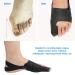 Toe Correction Bunion Adjuster - Ultrad nner Hallux Valgus Corrector & Orthopedic Braces for Bunion Relief - Buy Online on GoSupps.com