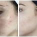 Buy HigherDOSE Light-Activated Glow Serum - Anti-Aging Vitamin C & Hyaluronic Acid Face Serum for Hydration & Fine Lines - Ships Internationally - Buy Online on GoSupps.com