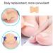 Toenail Correction Patch - Glue-Free Ingrown Toenail Sticker | 72 Pieces | Pedicure Tool for Men & Women - Buy Online on GoSupps.com