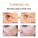 Turmeric Face Serum - Dark Spot Correcting Glow Serum with Turmeric Oil for Skin - Reduces Age Spots - Moisturzing Body & Face Oils and Serums. - Buy Online on GoSupps.com