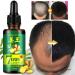 Advanced Hair Growth Serum - Accelerate Growth Thicken & Regrow Hair Anti-Hair Loss Treatment for Thin Hair - Buy Online on GoSupps.com