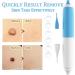 Skin Tag, Wart, Mole Removal Kit with 48 Bands & 10 Cleansing Wipes - Fast-Acting and Effective (2-8mm) - Buy Online on GoSupps.com