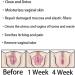 HENGBANG AnnieCare Instant Anti-Itch Detox Slimming Capsules - Firming and Repair for Clear, Fresh Skin (28 Capsules) - Buy Online on GoSupps.com