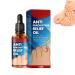 German Toenailcare Removal Paronychia Oil German Bunion Therapy Oil German Bunion Relief Oil German Toenailcare Anti Paronychia Relief Oil Repair for Damaged Discolored Thick Nails (1Pcs)