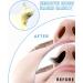 Nose Wax Kit Nose Wax Kit for Men and Women 100g Nose Hair Wax 20 Applicators Safe Tip Safe Fast Hair Wax for Nose Pai - Buy Online on GoSupps.com