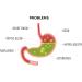 Buy BAN Acidinol Syrup 200ml - Fast International Shipping | Best Price & Quality - Buy Online on GoSupps.com