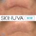 Skinuva Next Generation Scar Cream with Growth Factors - Advanced Scar Removal (1 oz) - Buy Online on GoSupps.com