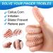 Cogana Gel Fingerlings - Breathable Silicone Fingertips for Trigger Fingers Hand Eczema Blisters & Arthritis (Beige) | International Shipping - Buy Online on GoSupps.com