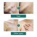 Vitiligo Cover Fluid for All Skin Tones - Waterproof Concealer Makeup 20ml for Men & Women - Buy Online on GoSupps.com