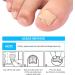 Toenail Patch Ingrown Toenail Toenail Correction Toenail Correction Patch Toenail Correction Patch Ingrown Toenail Nail Care 50 Pieces - Buy Online on GoSupps.com