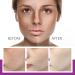  BEROZA Set of 3 creams for facial blemishes creams to remove facial blemishes whitening cream for freckles eliminates melasma and dark spots lightens skin - Buy Online on GoSupps.com