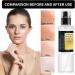 Snail Mucin Essence Snail Repair Face Serum Niacinamide Serum Snail Facial Serum Snail Hydrating Serums Snail Hyaluronic Acid Essence Face Skin Care Snail Essence Improve Dull Skin Essence 100ML - Buy Online on GoSupps.com