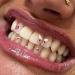 Chamon Tooth Gems | DIY Crystal Tooth Decorations | Pink Dental Jewelry & Gemstones - Buy Online on GoSupps.com