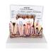PSVOD 4x 4 anatomi models for dental diseases combination models for frequent pathologies removable tooth for oral care education and teaching demonstration excellent