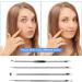 4PCS Blackhead Remover Tool Set for Acne, Comedone, Pimples, Spot, and Zit Extraction - Buy Online on GoSupps.com