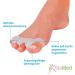 SiaMed 4x Hallux Valgus Toe Separator Splints - Soft Gel Silicone Splint for Foot Pain Relief - 2 Pairs for Hallux Valgus Treatment - International Shipping Available - Buy Online on GoSupps.com