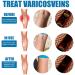 Varicose Veins Cream - Lichengtai Miracle Spray for Varicose & Spider Veins Relief - 3 Pack (20g) - Fast Muscle Soreness Relief - Buy Online on GoSupps.com