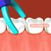 Smile Evolutionary Clean Dental Flossers Kit - 1 Mid-Length Handle +100 Extra Strength Refills - Buy Online on GoSupps.com