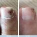 Australian Bodycare Nail Repair | Nail Care for Men & Women | Supports Damaged, Discolored & Fungal Nails | 10ml (Pack of 1) - Buy Online on GoSupps.com